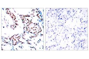 Immunohistochemistry (IHC) image for anti-Jun Proto-Oncogene (JUN) (Tyr170) antibody (ABIN1848122) (C-JUN 抗体  (Tyr170))