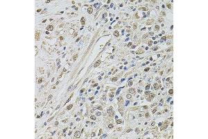 Immunohistochemistry (Paraffin-embedded Sections) (IHC (p)) image for anti-SWI/SNF Related, Matrix Associated, Actin Dependent Regulator of Chromatin, Subfamily C, Member 2 (SMARCC2) (AA 150-250) antibody (ABIN3022693)