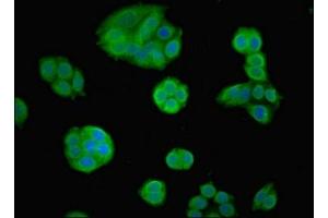 Immunofluorescent analysis of PC-3 cells using ABIN7153092 at dilution of 1:100 and Alexa Fluor 488-congugated AffiniPure Goat Anti-Rabbit IgG(H+L) (FOXP1 抗体  (AA 541-677))