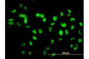Immunofluorescence (IF) image for anti-Sirtuin 1 (SIRT1) (AA 456-555) antibody (ABIN565071)