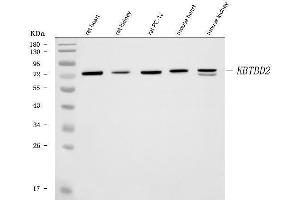 Western blot analysis of KBTBD2 using anti-KBTBD2 antibody (ABIN6719647). (KBTBD2 抗体)