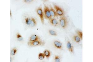 ICC testing of HSP70 antibody and A549 cells