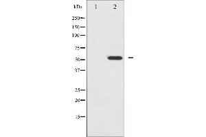 Western blot analysis of HNF4 alpha phosphorylation expression in EGF treated HuvEc whole cell lysates,The lane on the left is treated with the antigen-specific peptide. (HNF4A 抗体  (pSer313))