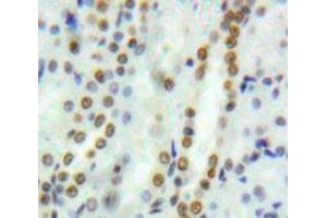 Used in DAB staining on fromalin fixed paraffin-embedded Kidney tissue (GATA2 抗体  (AA 117-338))