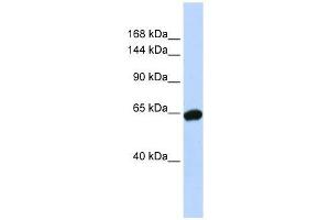 Western Blot showing ZNF91 antibody used at a concentration of 1-2 ug/ml to detect its target protein. (ZFP91 抗体  (N-Term))