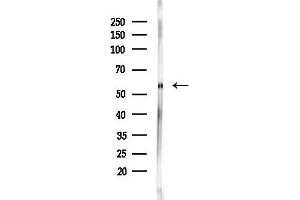 Western blot analysis of lysates from Hela cells(heat-shock,45 min treatment), using MDM4 Antibody at 1/1000 dilution.