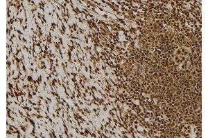 ABIN6276293 at 1/100 staining Human gastric tissue by IHC-P. (BCL2L1 抗体  (N-Term))
