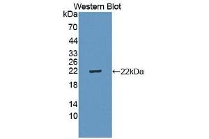 Detection of Recombinant IL5Ra, Mouse using Polyclonal Antibody to Interleukin 5 Receptor Alpha (IL5Ra) (IL5RA 抗体  (AA 41-203))