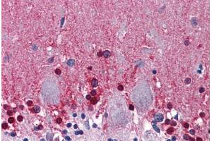 Human Brain, Cerebellum: Formalin-Fixed, Paraffin-Embedded (FFPE) (CBS 抗体  (AA 1-101))