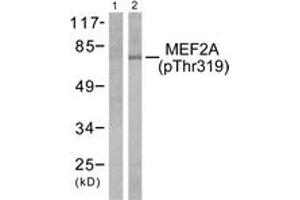 Western blot analysis of extracts from K562 cells treated with UV 15', using MEF2A (Phospho-Thr319) Antibody. (MEF2A 抗体  (pThr319))