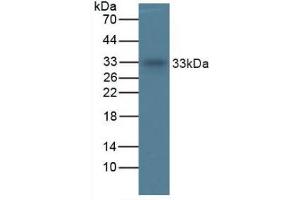 Figure. (TPSAB1 抗体  (AA 161-262))