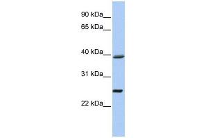 C12ORF42 antibody used at 1 ug/ml to detect target protein. (C12orf42 抗体  (N-Term))
