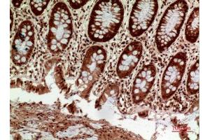 Immunohistochemistry (IHC) analysis of paraffin-embedded Human Colon, antibody was diluted at 1:100. (HLA-DQ1/DQ2 抗体  (Internal Region))