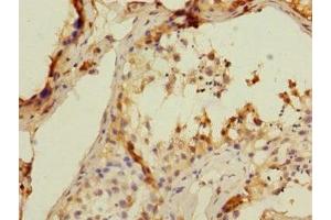 Immunohistochemistry of paraffin-embedded human testis tissue using ABIN7171407 at dilution of 1:100 (CD8B 抗体  (AA 22-170))