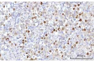 IHC analysis of RRP7A using anti-RRP7A antibody (ABIN7599044). (RRP7A 抗体  (AA 1-181))