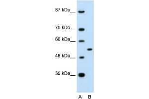 WB Suggested Anti-APBA1 Antibody Titration:  0.