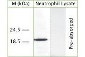 WB on human neutrophil lysate using Rabbit antibody to human Cathelicidin antimicrobial peptide (CAP-18, antibacterial protein LL-37, CAMP, CRAMP, FALL39): IgG (ABIN350184) at 50 µg/ml concentration. (Cathelicidin 抗体)