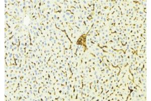 ABIN6275808 at 1/100 staining Mouse liver tissue by IHC-P. (CYP4V2 抗体  (Internal Region))