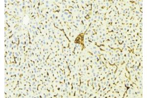 Immunohistochemistry (IHC) image for anti-Cytochrome P450, Family 4, Subfamily V, Polypeptide 2 (CYP4V2) (Internal Region) antibody (ABIN6258485)