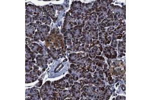 Immunohistochemical staining of human pancreas with FKBP9 polyclonal antibody  shows strong cytoplasmic positivity in exocrine glandular cells at 1:50-1:200 dilution. (FKBP9 抗体)