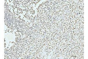 IHC analysis of p95 NBS1 using anti-p95 NBS1 antibody (ABIN7602793). (Nibrin 抗体  (C-Term))