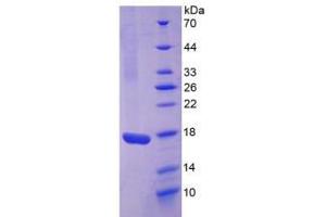 SDS-PAGE analysis of Rabbit Interleukin 17 Protein.
