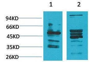 Western Blotting (WB) image for anti-Neuromedin B Receptor (NMBR) antibody (ABIN3179060) (NMBR 抗体)