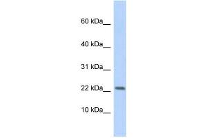WB Suggested Anti-P2RX7 Antibody Titration: 0. (P2RX7 抗体  (Middle Region))