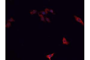 ABIN6266732 staining A-431 cells by IF/ICC. (PTTG1 抗体  (Internal Region))