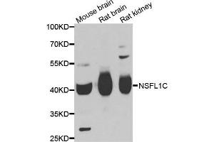 Western blot analysis of extracts of various cell lines, using NSFL1C antibody. (NSFL1C 抗体)