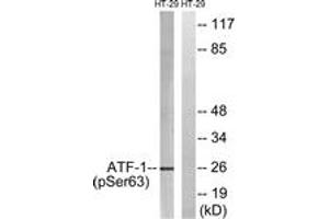 Western blot analysis of extracts from HT29 cells treated with Insulin 0. (AFT1 抗体  (pSer63))