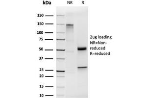 SDS-PAGE Analysis of Purified Cytokeratin 19 Rabbit Recombinant Monoclonal Antibody (KRT19/1959R). (Recombinant Cytokeratin 19 抗体)