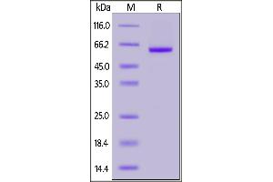 SDS-PAGE (SDS) image for SARS-CoV-2 Spike S1 (G476S), (RBD) protein (mFc Tag) (ABIN6952629)
