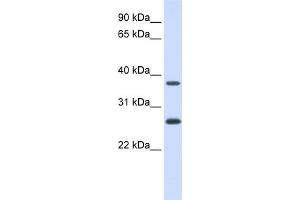 WB Suggested Anti-FAM156A Antibody Titration:  0. (FAM156A 抗体  (N-Term))