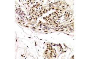 Immunohistochemistry of paraffin-embedded human breast using SNRPA Antibody. (SNRPA1 抗体)
