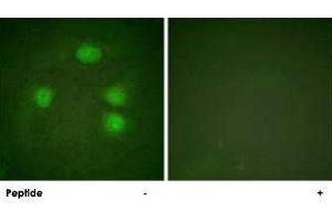 Immunofluorescence analysis of HeLa cells, using KCNJ3 polyclonal antibody . (KCNJ3 抗体  (Ser185))