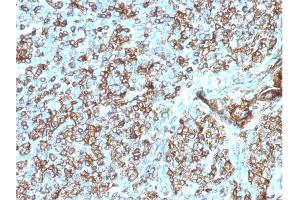 Formalin-fixed, paraffin-embedded human Tonsil stained with HLA- Pan Mouse Monoclonal Antibody (CR3/43). (MHC Class II HLA-DP/DQ/DR 抗体)