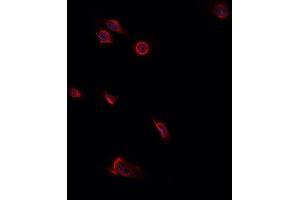 ABIN6276806 staining HepG2? (Decorin 抗体  (Internal Region))