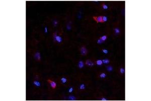 Netrin 4 antibody used at a concentration of 10 ug/ml to detect neurons and epithelial cells in rodent brain (red). (Netrin 4 抗体  (N-Term))