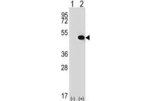 Western Blotting (WB) image for anti-Thyroid Hormone Receptor Interactor 13 (TRIP13) antibody (ABIN2996863) (TRIP13 抗体)
