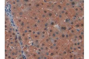 DAB staining on IHC-P; Samples: Human Liver Tissue (ARIP4 抗体  (AA 638-837))