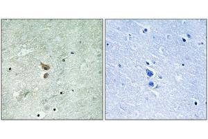 Immunohistochemistry analysis of paraffin-embedded human brain tissue using RIPK2 (Phospho-Ser176) antibody. (RIPK2 抗体  (pSer176))