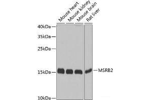 Western blot analysis of extracts of various cell lines using MSRB2 Polyclonal Antibody at dilution of 1:1000. (MSRB2 抗体)
