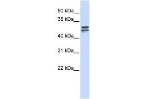 G6PD antibody used at 1 ug/ml to detect target protein. (Glucose-6-Phosphate Dehydrogenase 抗体  (Middle Region))