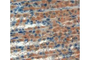 Figure. (GREM1 抗体  (AA 26-184))