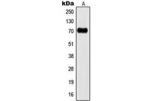 Western blot analysis of Kv3. (KCNC2 抗体  (C-Term))