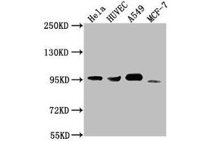 Western Blot Positive WB detected in: Hela whole cell lysate, HUVEC whole cell lysate, A549 whole cell lysate, MCF-7 whole cell lysate All lanes: CD44 antibody at 1:1500 Secondary Goat polyclonal to Mouse IgG at 1/10000 dilution Predicted band size: 82, 4, 78, 77, 81, 79, 75, 54,47, 40, 44, 33, 74, 76, 38, 16 kDa Observed band size: 95 kDa (CD44 抗体  (AA 21-220))