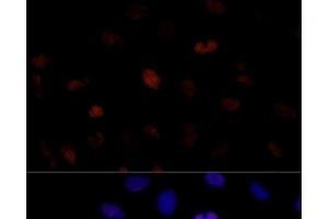 Immunofluorescence analysis of U-2 OS cells using PSME3 Polyclonal Antibody at dilution of 1:100 (40x lens). (PSME3 抗体)