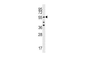 Cdc25A Antibody (S78) (ABIN390215 and ABIN2840697) western blot analysis in MCF-7 cell line lysates (35 μg/lane). (CDC25A 抗体  (AA 57-84))