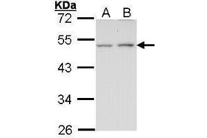 WB Image Sample (30 ug of whole cell lysate) A: A431 , B: H1299 10% SDS PAGE antibody diluted at 1:1000 (EDNRB 抗体  (N-Term))